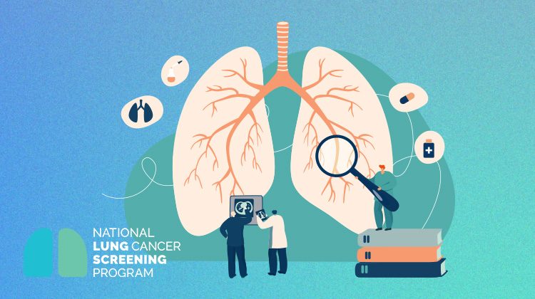 National Lung Cancer Screening Program